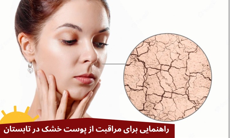 راهنمایی برای مراقبت از پوست خشک در تابستان